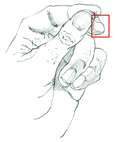 Figura 25. Signo de la misma uña en el contexto más amplio del signo mano.